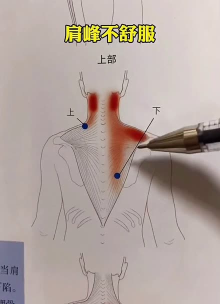 后背僵硬不舒服试试放松斜方肌下束这个点吧每天放松2到3次每次2分钟